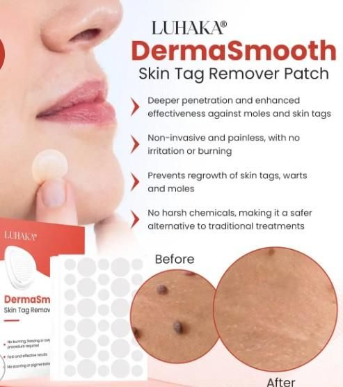 Best Skin Tag Remover Patches - 144 Pcs Natural Removal Kit for All Skin Types
